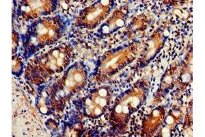 Immunohistochemistry of paraffin-embedded human small intestine tissue using ABIN7162833 at dilution of 1:100 (FKBP3 Antikörper  (AA 2-224))