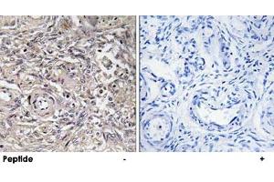 Immunohistochemistry analysis of paraffin-embedded human ovary tissue using CLDN6 polyclonal antibody . (Claudin 6 Antikörper)
