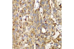 Immunohistochemistry (Paraffin-embedded Sections) (IHC (p)) image for anti-serine Hydroxymethyltransferase 2 (Mitochondrial) (SHMT2) (AA 265-504) antibody (ABIN3021747)
