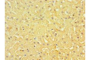 Immunohistochemistry of paraffin-embedded human liver tissue using ABIN7151877 at dilution of 1:100 (Ephrin B1 Antikörper  (AA 28-237))