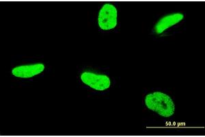 Immunofluorescence of monoclonal antibody to TAF12 on HeLa cell. (TAF12 Antikörper  (AA 1-161))