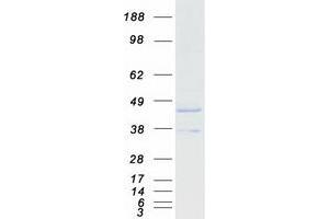 Western Blotting (WB) image for Acyl-CoA Dehydrogenase, C-2 To C-3 Short Chain (Acads) protein (Myc-DYKDDDDK Tag) (ABIN2714301)