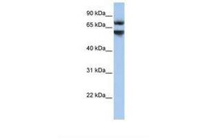 Junctophilin 3 Antikörper  (N-Term)