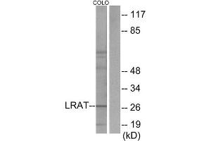 Western Blotting (WB) image for anti-Lecithin Retinol Acyltransferase (Phosphatidylcholine--Retinol O-Acyltransferase) (LRAT) (Internal Region) antibody (ABIN1849061) (LRAT Antikörper  (Internal Region))