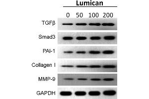 Lumican promotes the expression of protein level in fibrosis. (MMP 9 Antikörper  (AA 538-707))