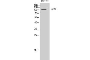 Western Blot analysis of 293T-UV cells using EphA3 Polyclonal Antibody diluted at 1:500.