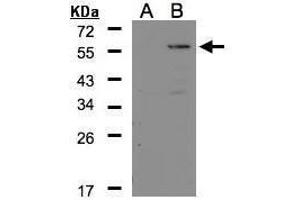WB Image Western Blot analysis of CPE expression in transfected 293T cell line by CPE polyclonal antibody. (CPE Antikörper)