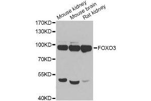 Western blot analysis of extracts of various cell lines, using FOXO3 antibody. (FOXO3 Antikörper  (AA 394-672))