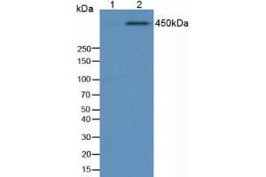 Detection of TP53BP1 in Human 293 Cells using Anti-Phosphorylated Tumor Protein p53 Binding Protein 1 (TP53BP1) Polyclonal Antibody (TP53BP1 Antikörper  (pSer1778))