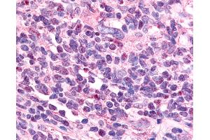 Immunohistochemistry (IHC) image for anti-Nuclear Receptor Subfamily 2, Group F, Member 6 (NR2F6) (N-Term) antibody (ABIN1049139)
