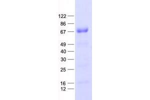 Western Blotting (WB) image for Nuclear Factor of kappa Light Polypeptide Gene Enhancer in B-Cells Inhibitor, epsilon (NFKBIE) protein (His tag) (ABIN2727232)