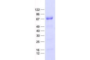 Validation with Western Blot (NFKBIE Protein (His tag))