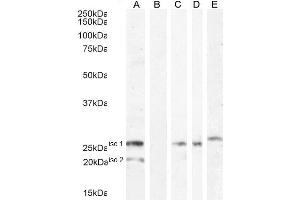 ABIN334524 (1ug/ml) staining of HEK293 iso 1 + iso 2 cell lysate (A) + peptide (B). (VTCN1 Antikörper  (Internal Region))