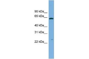 WB Suggested Anti-GSTA3 Antibody Titration:  0. (GSTA3 Antikörper  (Middle Region))