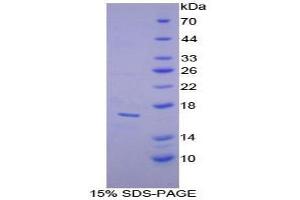 SDS-PAGE analysis of Mouse alpha Lactalbumin Protein.