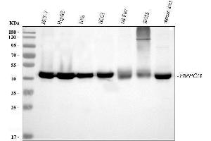 Western blot analysis of PMPCB using anti-PMPCB antibody (ABIN7600757). (PMPCB Antikörper  (AA 23-479))