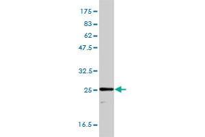 TPI1 monoclonal antibody (M01), clone 1D10-2E2 Western Blot analysis of TPI1 expression in HepG2 . (TPI1 Antikörper  (AA 1-249))