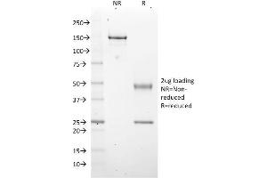 SDS-PAGE Analysis Purified EZH2 / KMT6 Mouse Monoclonal Antibody (EZH2/2536). (EZH2 Antikörper)