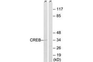 Western blot analysis of extracts from Jurkat cells, using CREB (Ab-100) Antibody. (CREB1 Antikörper  (AA 71-120))