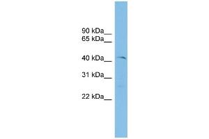 WB Suggested Anti-ETV7 Antibody Titration: 0. (ETV7 Antikörper  (N-Term))