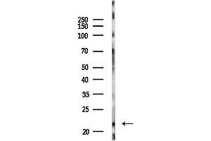 Western blot analysis of lysates from COLO205 cells(heat-shock,45 min treatment), using BID Antibody at 1/1000 dilution.