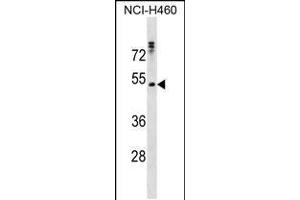 Western blot analysis in NCI-H460 cell line lysates (35ug/lane). (RHCG Antikörper  (AA 184-213))