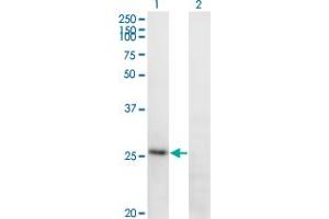 Western Blot analysis of FGA expression in transfected 293T cell line by FGA monoclonal antibody (M01), clone 1D12.
