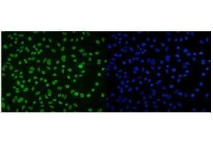 IF analysis of DDX5 using anti-DDX5 antibody (ABIN7602561). (DDX5 Antikörper  (AA 85-328))