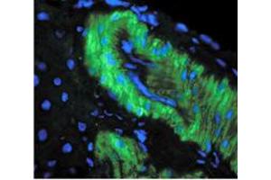 Image no. 1 for anti-Nitrotyrosine antibody (ABIN466935) (Nitrotyrosine Antikörper)