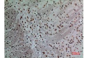 Immunohistochemistry (IHC) analysis of paraffin-embedded Mouse Brain, antibody was diluted at 1:100.