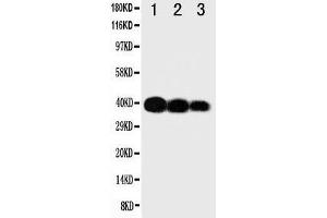 Western Blotting (WB) image for anti-Interleukin 12 beta (IL12B) (AA 23-40), (N-Term) antibody (ABIN3043199) (IL12B Antikörper  (N-Term))