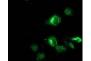 Anti-ANKRD53 mouse monoclonal antibody (ABIN2454354) immunofluorescent staining of COS7 cells transiently transfected by pCMV6-ENTRY ANKRD53 (RC206701). (ANKRD53 Antikörper  (AA 1-300))