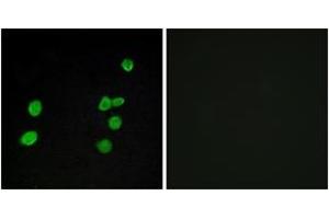 Immunofluorescence analysis of MCF7 cells, using p97 MAPK Antibody. (MAPK6 Antikörper  (AA 461-510))