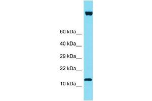 Western Blotting (WB) image for anti-IQ Motif Containing F6 (IQCF6) (C-Term) antibody (ABIN2774552) (IQCF6 Antikörper  (C-Term))