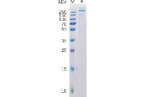 SDS-PAGE (SDS) image for Melanoma Associated Chondroitin Sulfate Proteoglycan (MCSP) (AA 30-2224) protein (His tag) (ABIN6964100)
