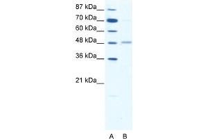 WB Suggested Anti-GABRA2 Antibody Titration:  1. (GABRA2 Antikörper  (Middle Region))