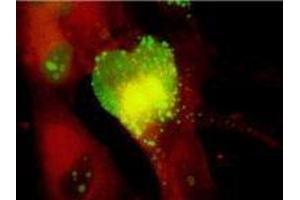 ELISA image for anti-Cytomegalovirus p65 (CMV p65) antibody (ABIN265537) (CMV p65 Antikörper)