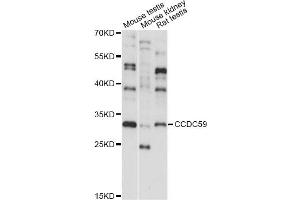 Western blot analysis of extracts of various cell lines, using CCDC59 antibody (ABIN6293275) at 1:1000 dilution. (CCDC59 Antikörper)