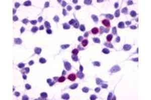 Anti-GPRC5A / RAI3 antibody immunocytochemistry (ICC) staining of HEK293 human embryonic kidney cells transfected with GPRC5A / RAI3. (GPRC5A Antikörper  (Extracellular Domain))