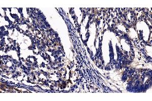 Immunohistochemistry (IHC) image for anti-Integrin alpha V (ITGAV) (AA 560-744) antibody (ABIN7445879)