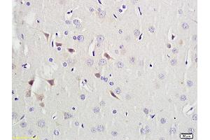 Formalin-fixed and paraffin embedded rat brain labeled with Anti-PAX9 Polyclonal Antibody, Unconjugated (ABIN737691) followed by conjugation to the secondary antibody and DAB staining (PAX9 Antikörper  (AA 271-341))