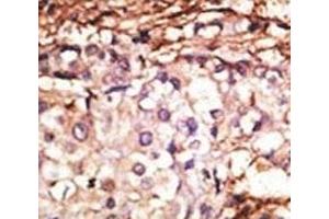 Immunohistochemistry (IHC) image for anti-Protein Arginine Methyltransferase 6 (PRMT6) (AA 19-48) antibody (ABIN3032363)
