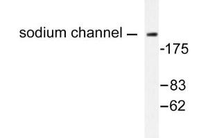 Image no. 1 for anti-Na+ Channel Protein antibody (ABIN271819) (Na+ Channel Protein Antikörper)