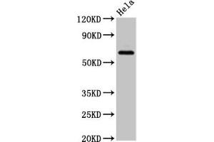 Western Blot Positive WB detected in: Hela whole cell lysate All lanes: SLC22A25 antibody at 6. (SLC22A25 Antikörper  (AA 31-145))