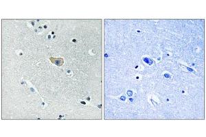 NMDAR1 (Phospho-Ser890) antibody reacts with epitope-specific phosphopeptide and corresponding non-phosphopeptide. (GRIN1/NMDAR1 Antikörper  (pSer890))