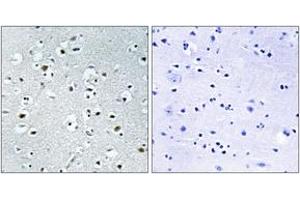 Immunohistochemistry (IHC) image for anti-Peroxisome Proliferator-Activated Receptor Gamma, Coactivator-Related 1 (PPRC1) (AA 1609-1658) antibody (ABIN2890496) (PPRC1 Antikörper  (AA 1609-1658))