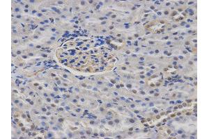 Immunohistochemistry (IHC) image for anti-Calcium/calmodulin-Dependent serine Protein Kinase (MAGUK Family) (CASK) antibody (ABIN1871447) (CASK Antikörper)
