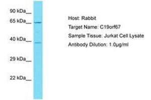 Image no. 1 for anti-Chromosome 19 Open Reading Frame 67 (C19ORF67) (AA 76-125) antibody (ABIN6750821) (C19ORF67 Antikörper  (AA 76-125))