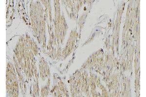 ABIN6274651 at 1/100 staining Mouse muscle tissue by IHC-P. (CYP2R1 Antikörper  (Internal Region))