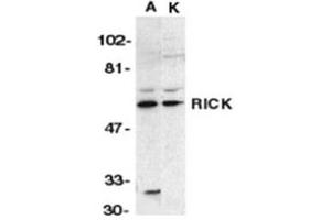 Image no. 1 for anti-Receptor-Interacting Serine-threonine Kinase 2 (RIPK2) (N-Term) antibody (ABIN318972) (RIPK2 Antikörper  (N-Term))